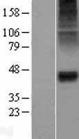 alpha 1 Glycine Receptor (GLRA1) Human Over-expression Lysate