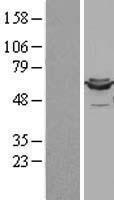 Lipoamide Dehydrogenase (DLD) Human Over-expression Lysate