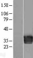 Endothelin 3 (EDN3) Human Over-expression Lysate