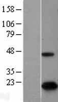p16INK4A (CDKN2A) Human Over-expression Lysate