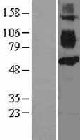 CD36 Human Over-expression Lysate