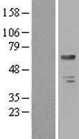 BTD Human Over-expression Lysate