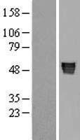 Angiotensinogen (AGT) Human Over-expression Lysate