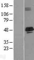 ACADS Human Over-expression Lysate