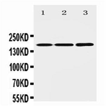 NMDAR2B/GRIN2B Antibody