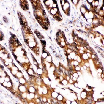 Caspase-6(P18)/CASP6 Antibody