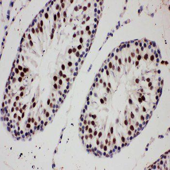 E3 SUMO-protein ligase PIAS1 PIAS1 Antibody