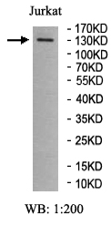 MYO1F Rabbit Polyclonal Antibody
