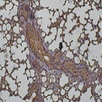 Anti-Cathepsin D