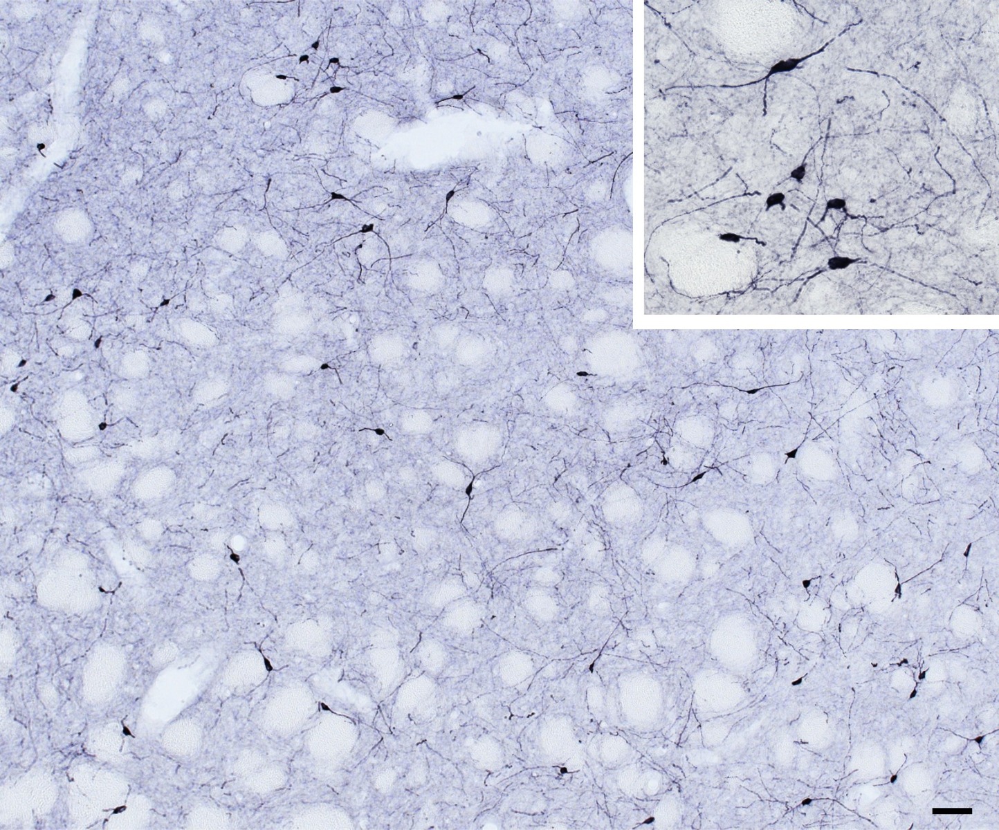 NOS1 Antibody