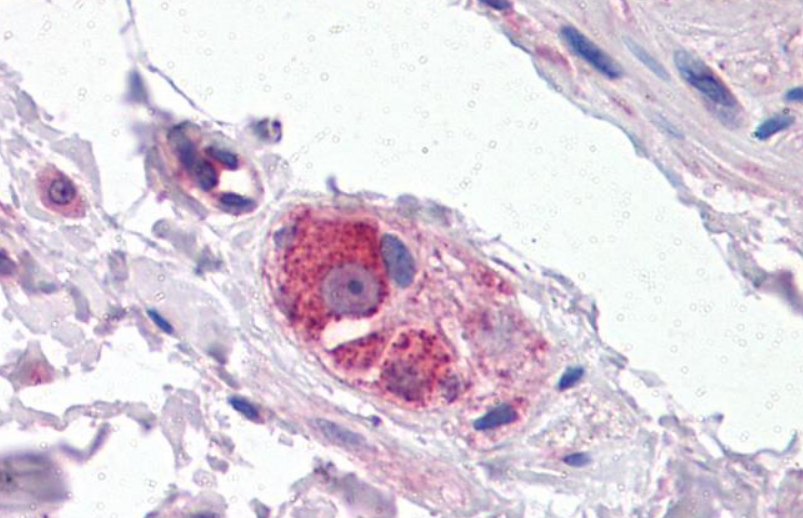 CYP26B1 Antibody