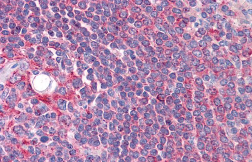 CYP26B1 Antibody