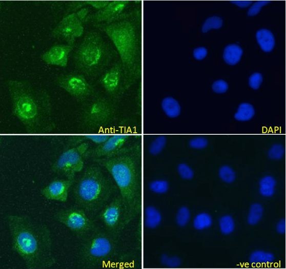 TIA1 Antibody