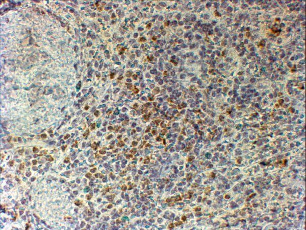 CYBB/GP91-PHOX Antibody