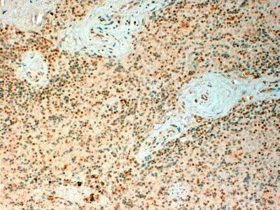 TET2 Antibody