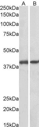 GNAQ/ALPHA-q (aa162-175) Antibody