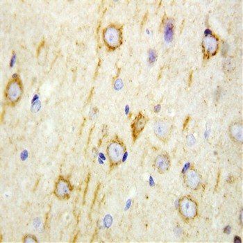GAD65/GAD2 Antibody