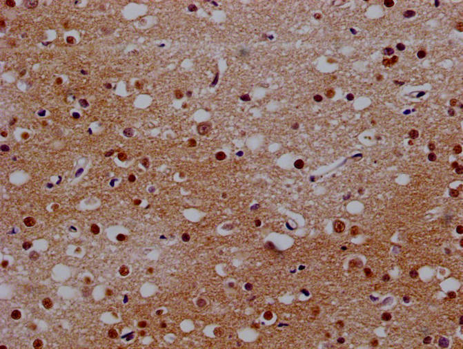 BCL11A Antibody