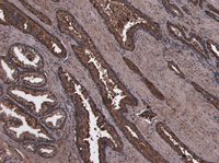 HOXD13 Antibody