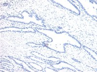 HOXD13 Antibody