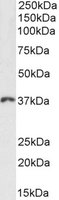 HOXD13 Antibody