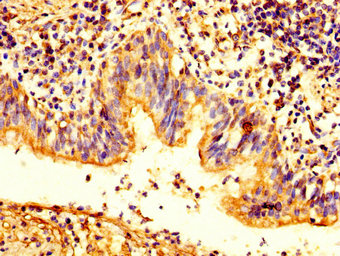 PKP2 Antibody, Biotin conjugated
