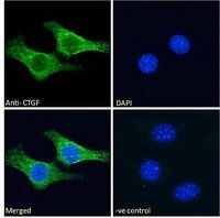 CTGF (aa111-123) Antibody
