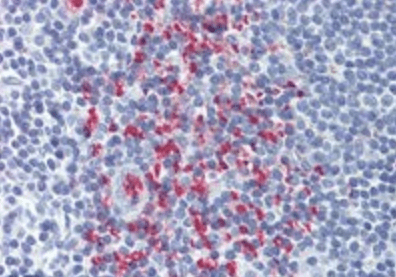 OCIL Antibody