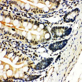 NFkB/NFKB2 p100/p52 Antibody