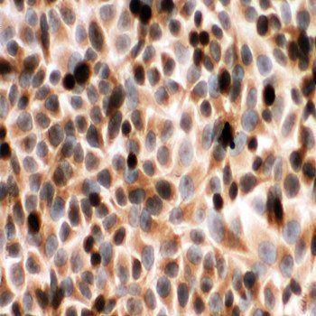 Cytochrome P450 Reductase/POR Antibody