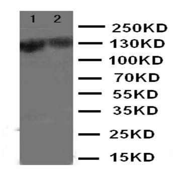 Smad Interacting Protein 1/ZEB2 Antibody