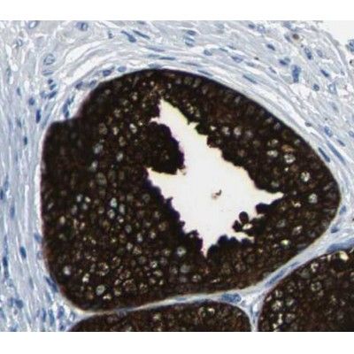 mTOR Antibody