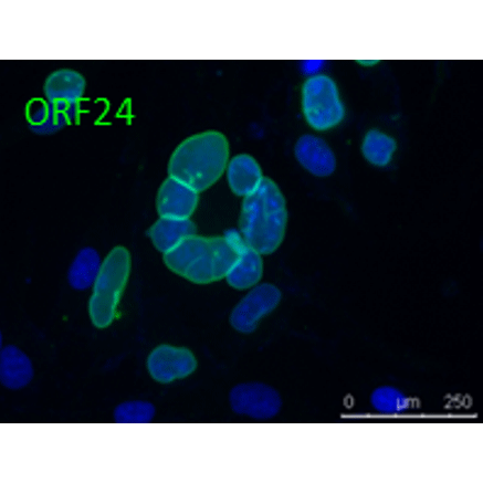 Anti-ORF24 (VZV) antibody