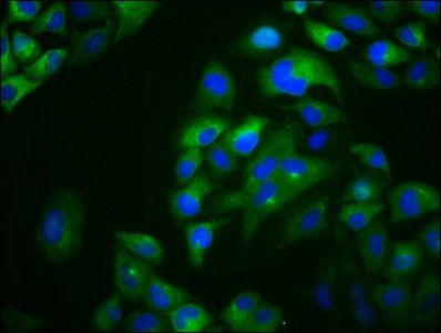 OTOP1 Antibody