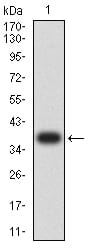 CD182