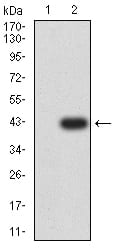 CD182