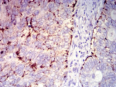 CD182