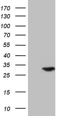 S100 alpha 6 Antibody