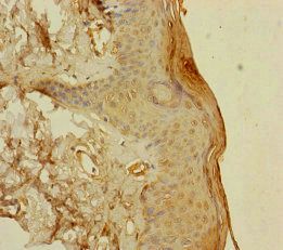 S100A14 Antibody