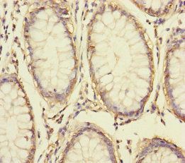 S100A14 Antibody