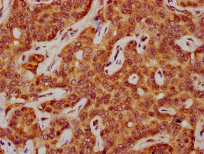SAA2 Antibody
