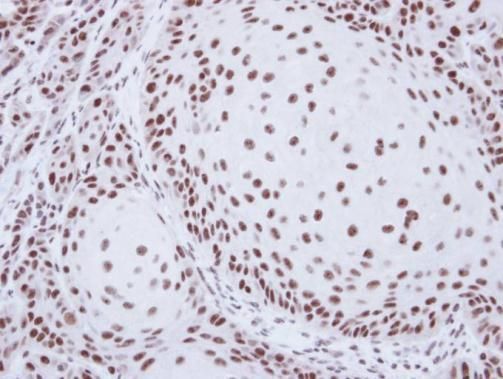 SART1 antibody [N2C1], Internal