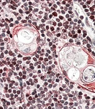 SATB1 Antibody