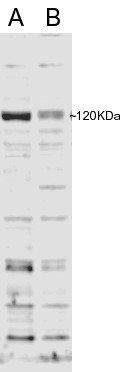 SBP2 Antibody