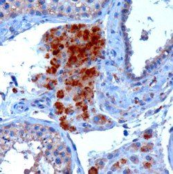 SBP2 Antibody