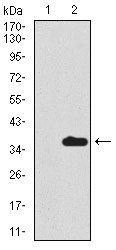 SCGB1A1