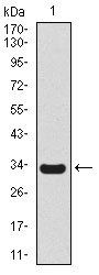 SCGB1A1