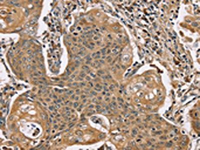 SCGB2A1 Antibody