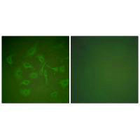 SCGB2A2 Antibody