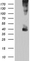 SCHIP1 Antibody